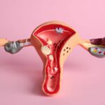 HIV positive women fight for justice after sterilisation