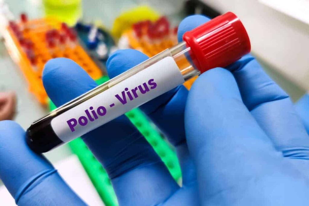 Polio strains found in sewage but SA still polio free