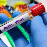 Polio strains found in sewage but SA still polio free