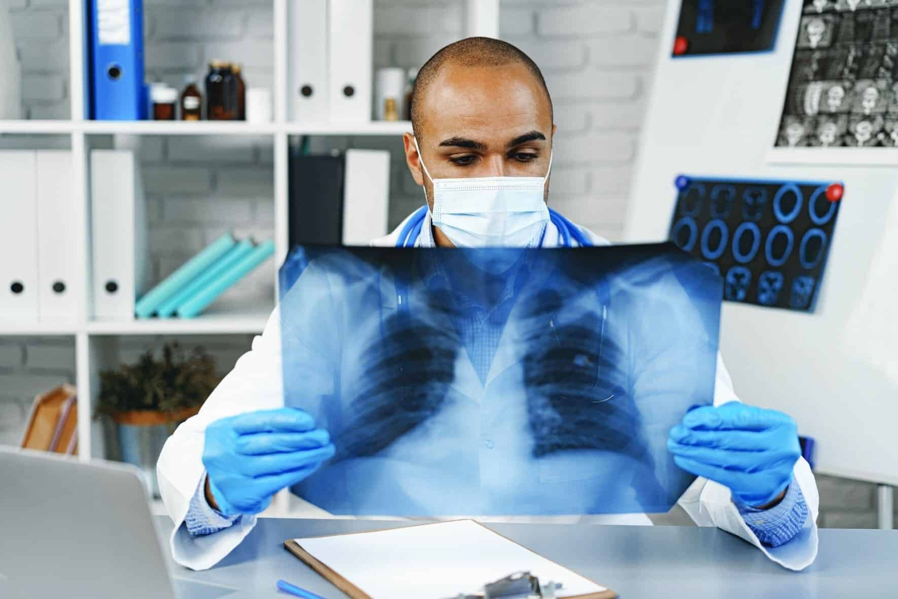 Social and systemic failures blamed for ongoing TB crisis
