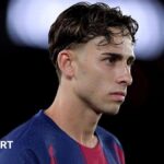 Spain: Fermin Lopez out of World Cup with broken bone in foot