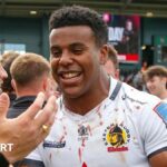 Immanuel Feyi-Waboso: England winger to have facial injury surgery